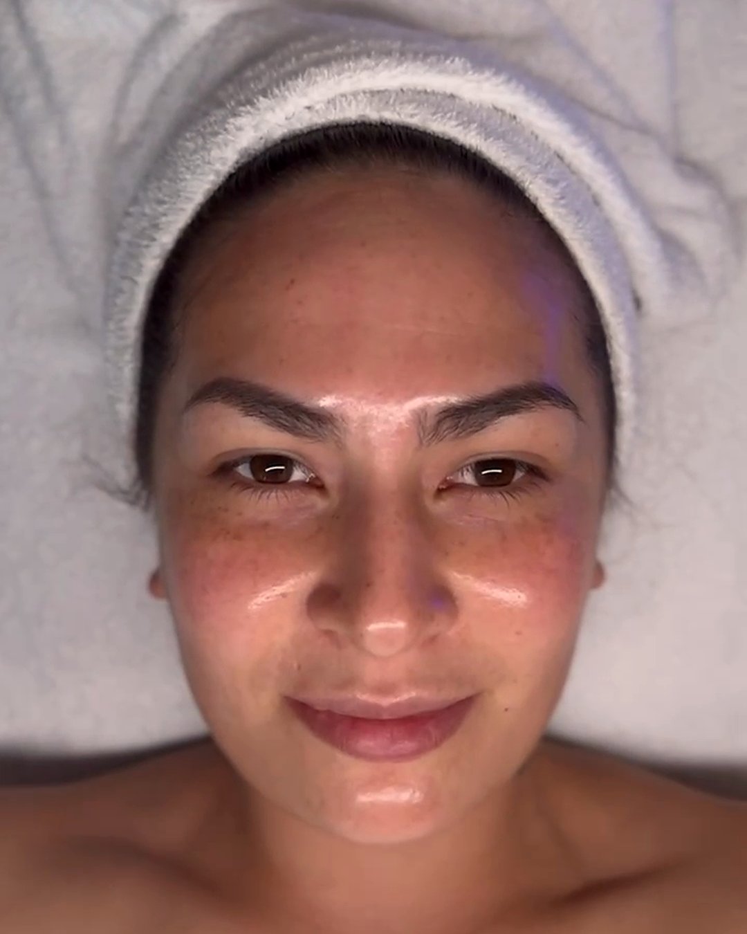 Hydrafacial Deep Harmony – Premium Gesichtsbehandlung