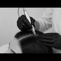Microneedling Kopfhaut – Haarwachstum & Revitalisierung mit Exosomen